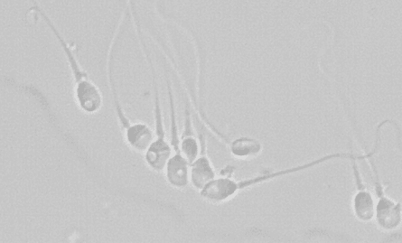 Imagen de microscopio de técnica IMSI