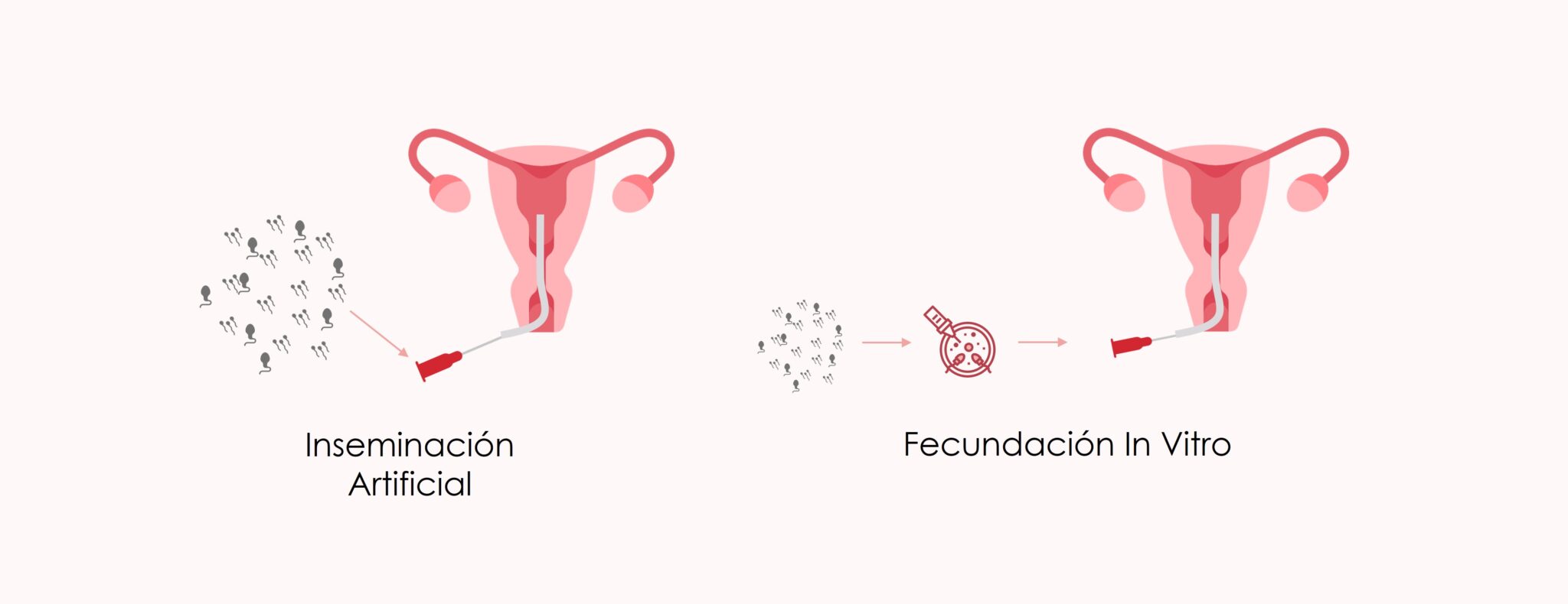 ¿cómo Se Puede Lograr El Embarazo Con Pocos Espermatozoides