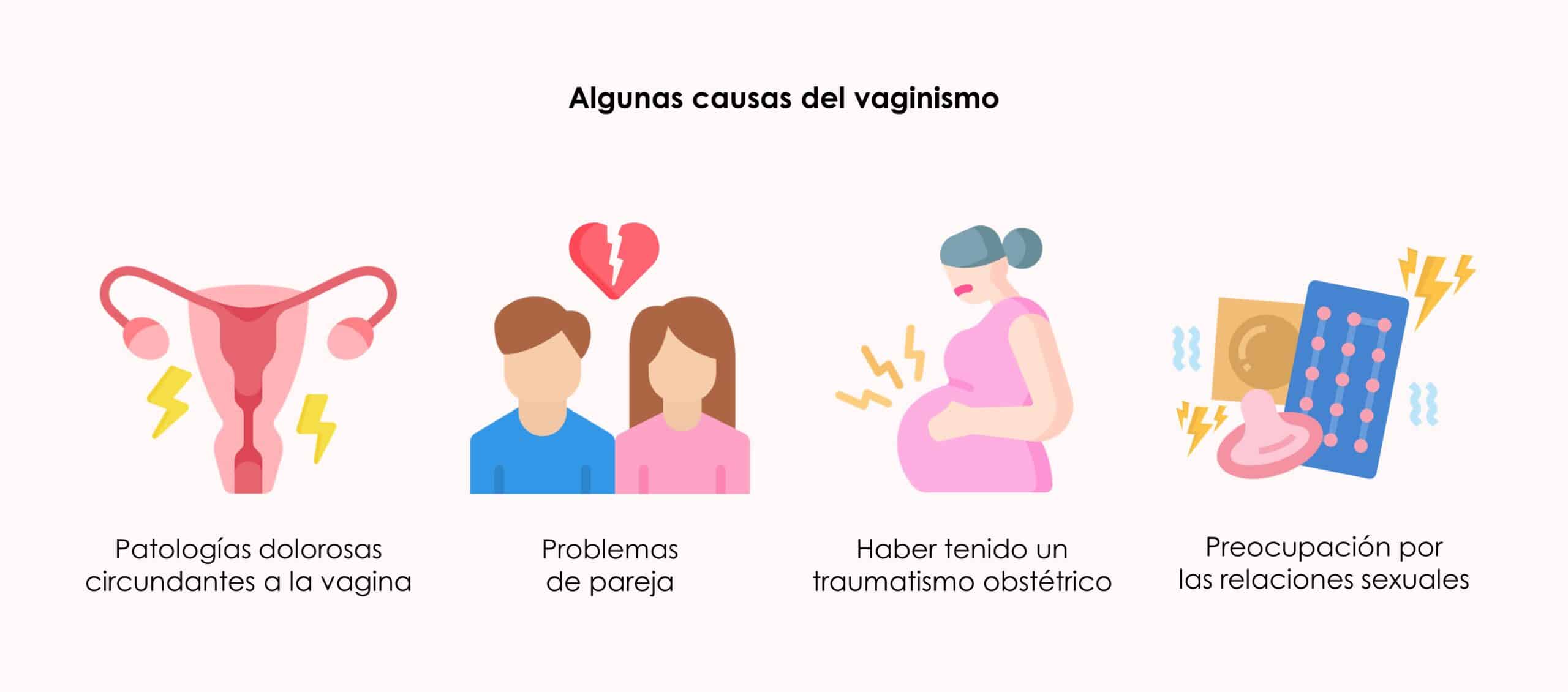 vaginismo