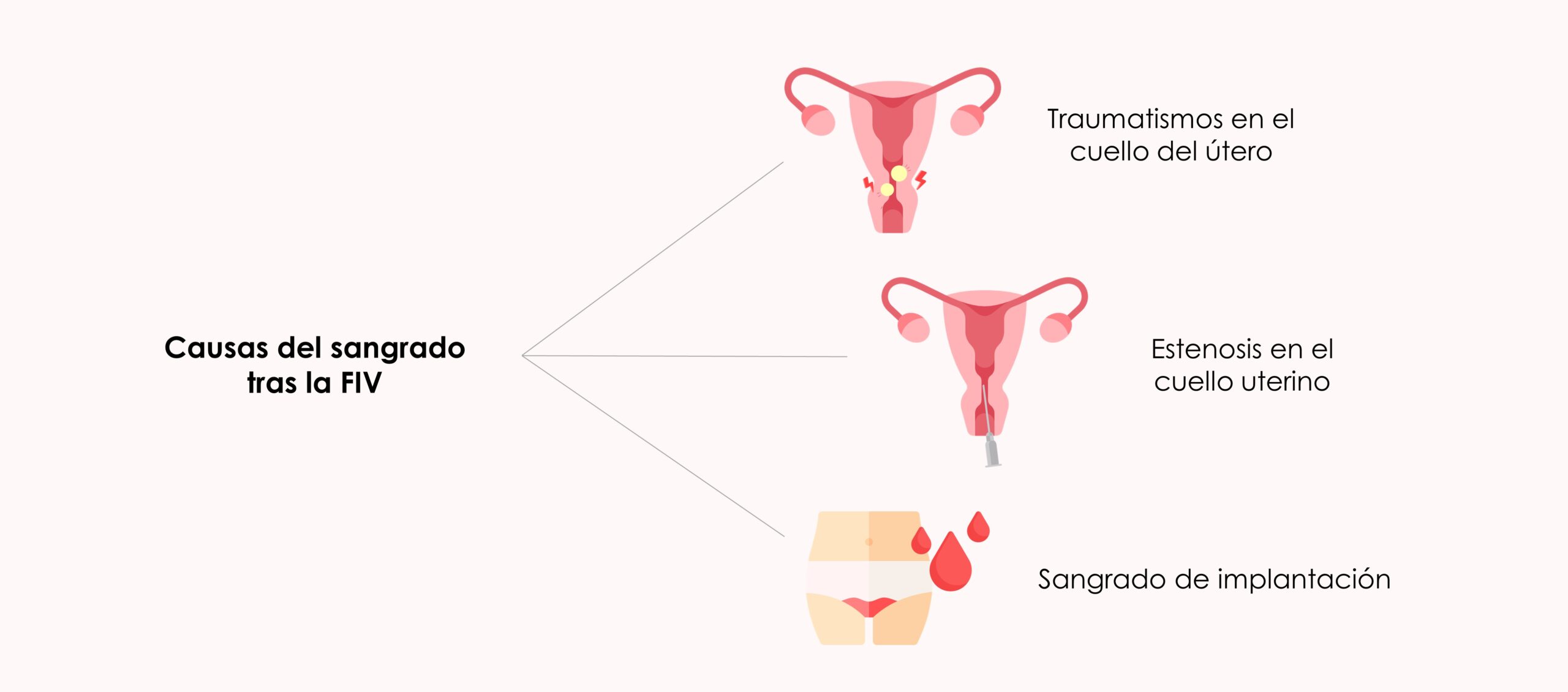 Causas del sangrado de implantación