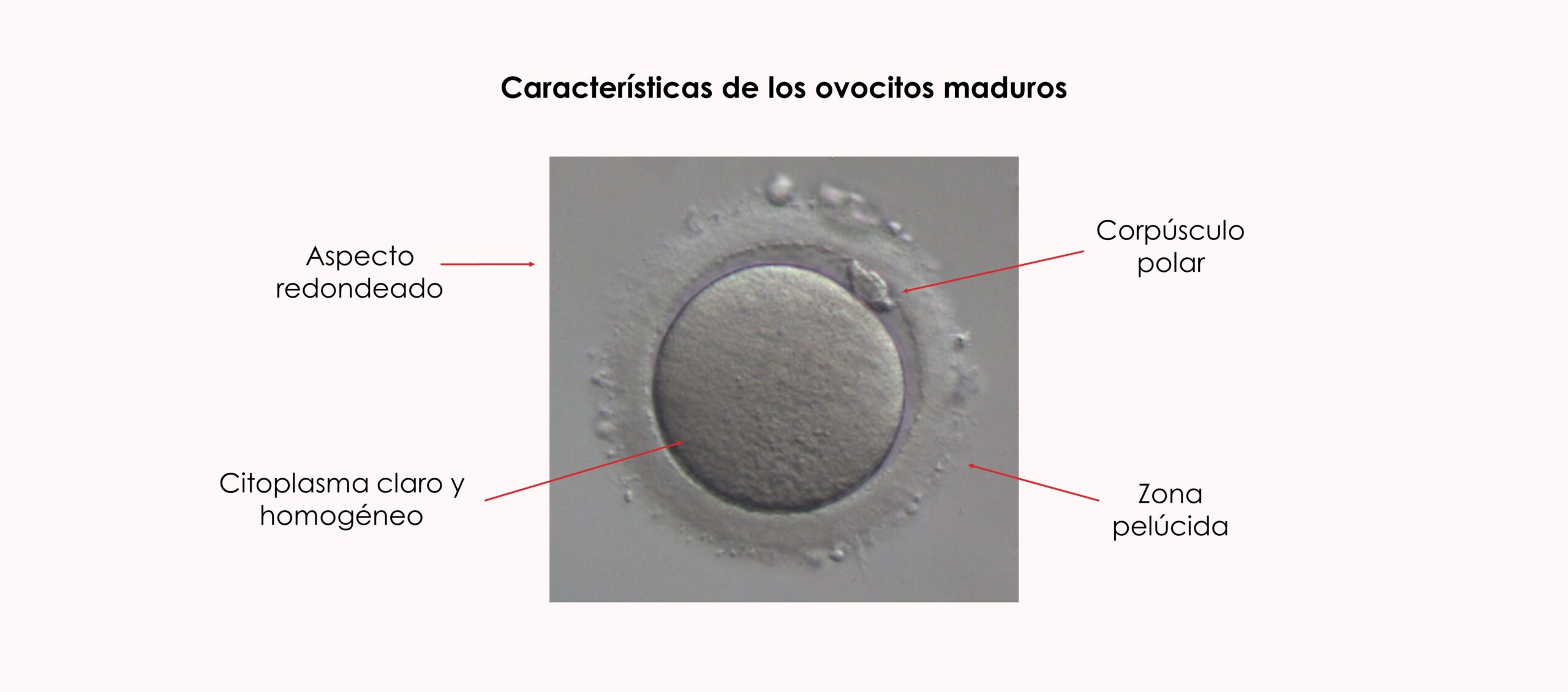 Características ovocitos maduros