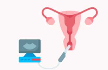 ¿Qué es la ecografía transvaginal? Todo sobre esta prueba de fertilidad